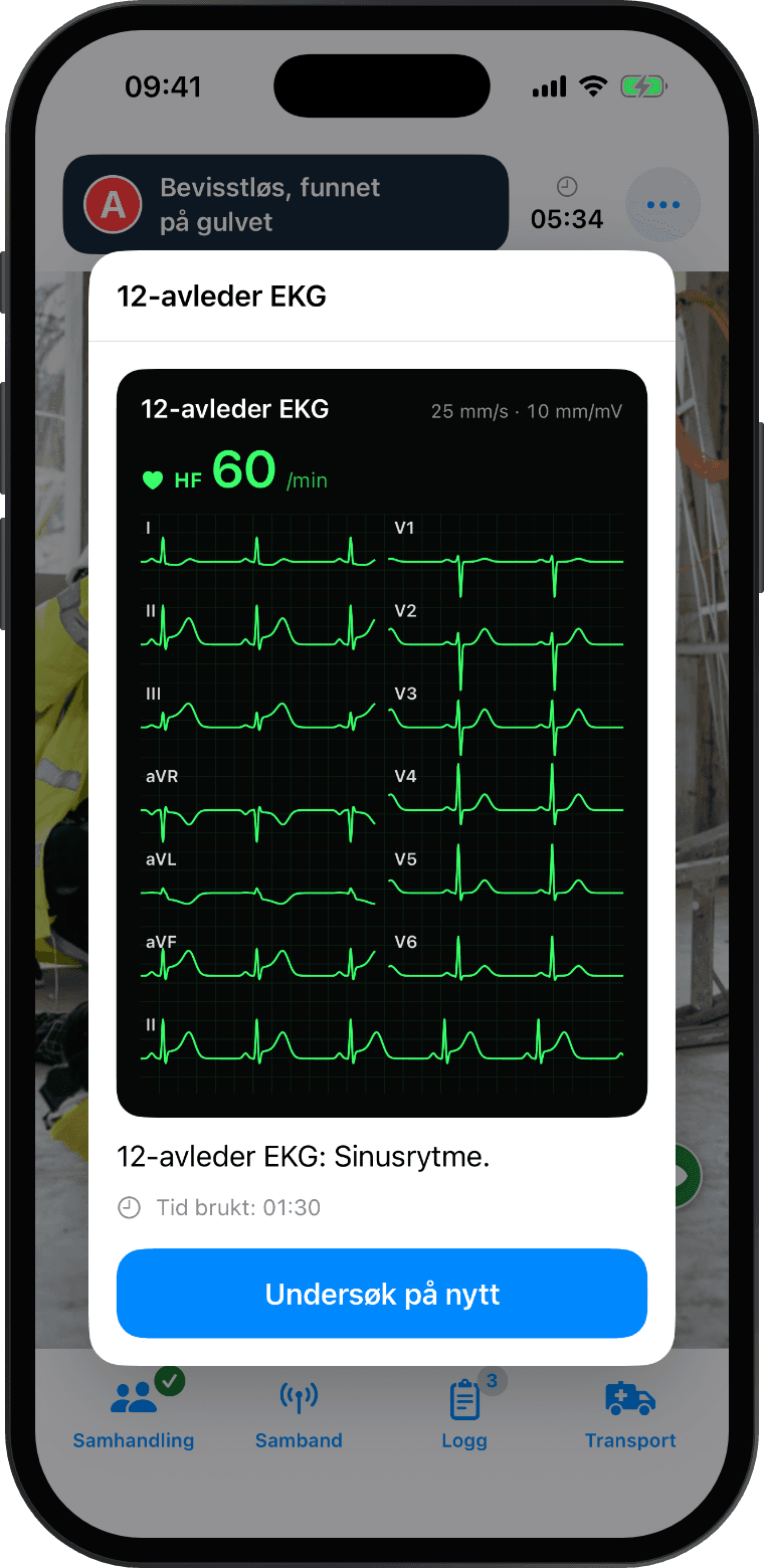 12-avleder EKG på multimonitoren, med ST-elevasjon i II, III og aVF